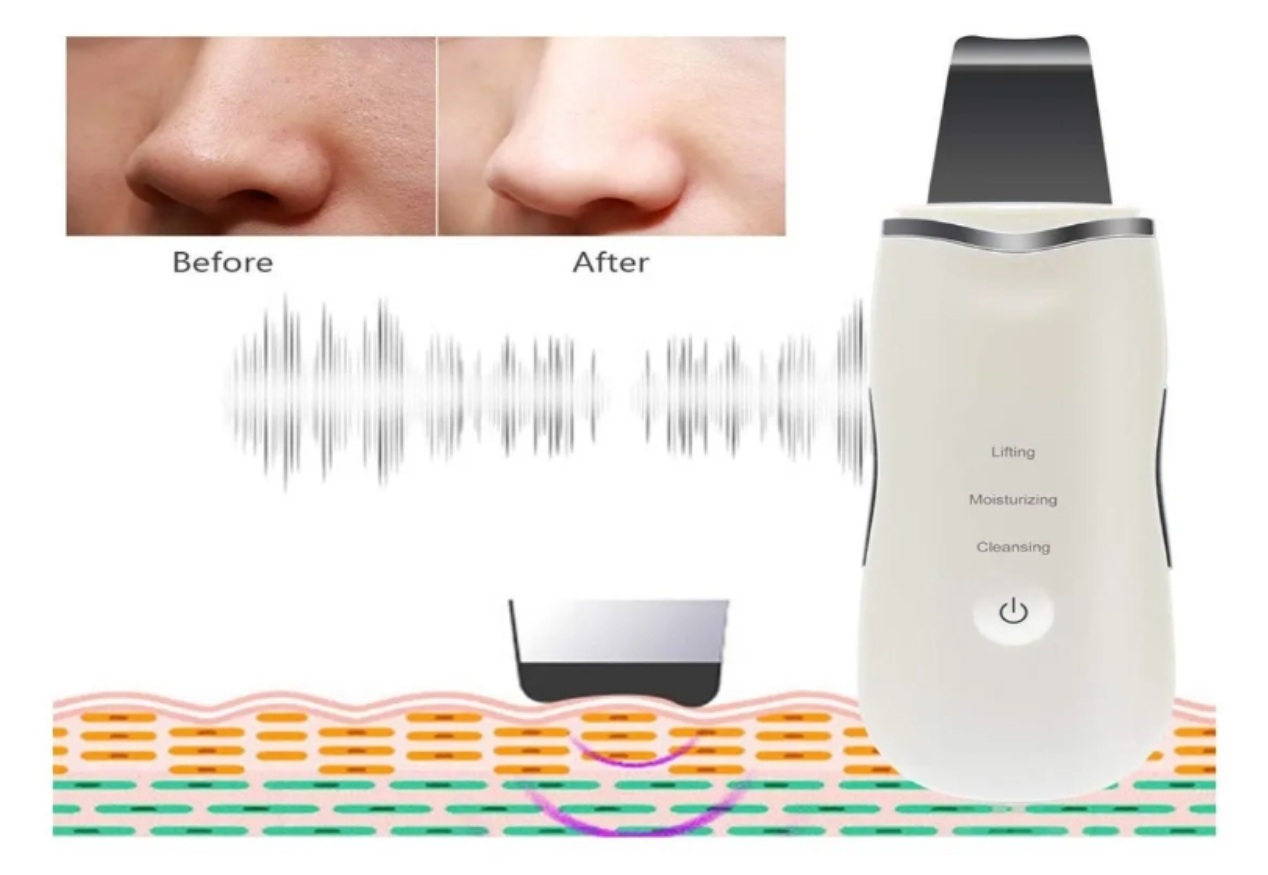 Limpiador Espátula Ultrasonido Facial Removedor Depurador
